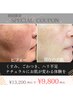 【 くすみオフ×透明感up 】高濃度ヒト幹細胞培養液エクソソームフェイシャル