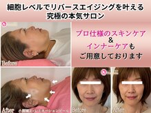 アンリエッタ(Unlieta)