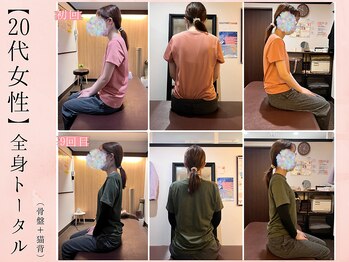 サクラ(SAKURA)/【20代後半】BeforeAfter