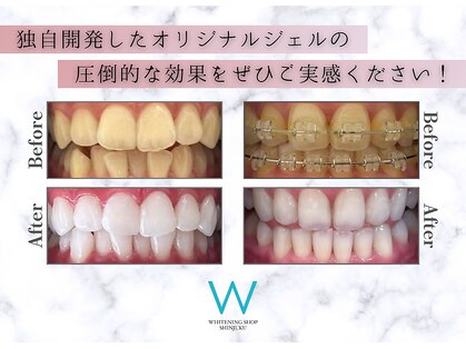 ホワイトニングショップ 新宿店の写真