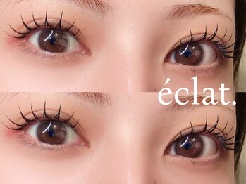 エクラ(eclat.)の写真/パリジェンヌとマツエクの同時施術[アンドヘルシー]で逆さまつ毛等お悩みも解決★目の形に合うデザインに♪