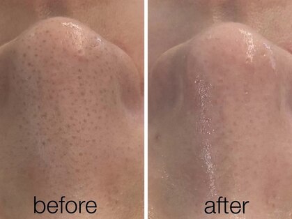 リスポアラボ(LIS PORE.LAB)の写真