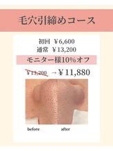 ナーズプラス リベルテ(Naz Plus/Liberte)/