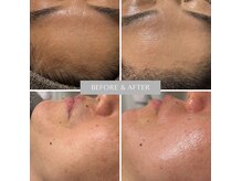 エステ リラクゼーションサロン(more)