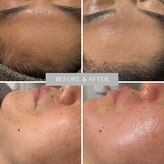 エステ リラクゼーションサロン(more)