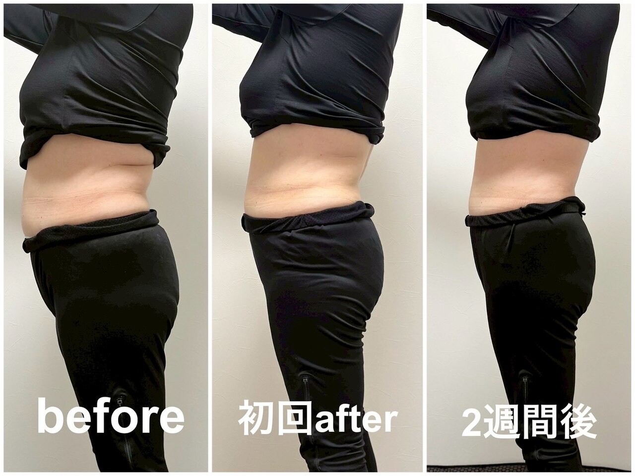 横浜市南区でダイエットが人気のエステサロン｜ホットペッパービューティー