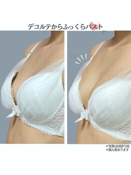 サムサラ(SamSara)の写真/【バスト専門】バストを上げあなたも上げていくサロンSamSara独自の施術であちこち逃げたお肉をバストへ！