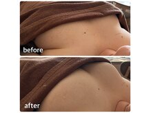 諦めなくても大丈夫！施術前後の違いを実感してください！