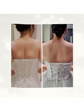 サンテボーテ(Sante Beaute)/ブライダルエステ