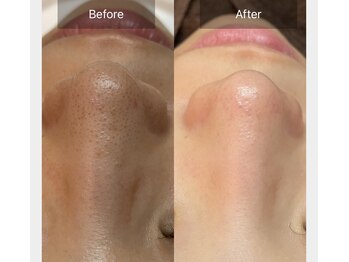 ラウレア(Laule’an)/