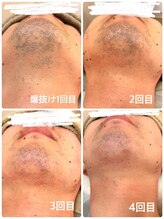 ティアレ 廿日市店(Tiare)/爆抜け効果