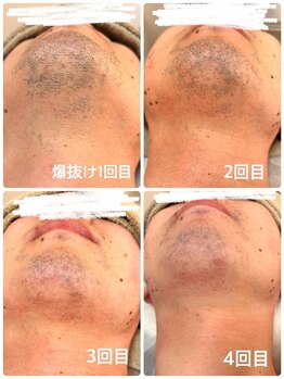 ティアレ 廿日市店(Tiare)/爆抜け効果