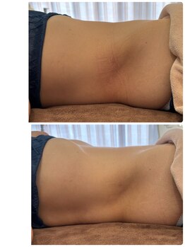 ディアウーマン(Dear Woman)/くびれ作りは【浮き輪肉撃退】