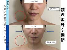 お顔の研究所/ビフォーアフター写真♪