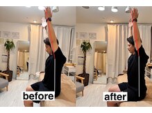 ヘルシールーム 六本木7丁目店(Healthy room)/before/after【肩甲骨/姿勢】