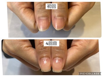 アンドネイル 海老名(&nail)/自爪育成ジェル　4回目のお客様