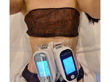 ステラ(Stella)/【脂肪冷却】いよいよスタート