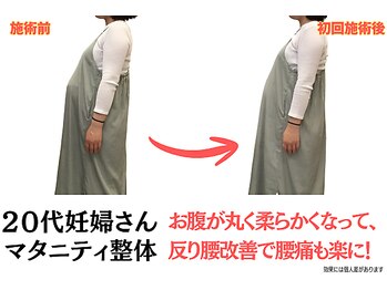 ニノ治療院(Nino治療院)/マタニティ整体の変化