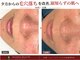 セレニア ボーテ(Selenia Beaute)の写真/昔と違う毛穴悩みに、肌状態から見直す本格ケア