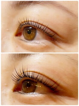 リラクゼーションサロン アロマ ラ ボーテ/ラッシュアディクト使用