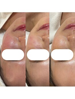 ファミーユ(famille)/施術【Beauty Salon famille】