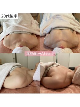 ルト(RUTO)/産後下垂も豊胸級のエステ◎