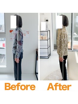 整体院ひなた 都城院/80代女性でも改善！