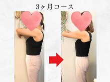 バランス鍼灸整骨院/万年ダイエットをしている方に