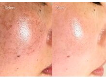 シューラディアント(ShuRadiant)/リアボーテハーブトリートメント