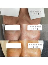 ミランジュ(miranju)/光フェイシャル