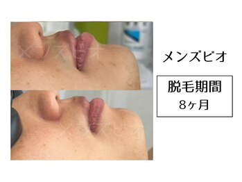 メンズビオ 神戸三宮店/