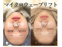 ナナイロヨジドン(nanairo麗姿堂)の雰囲気（話題のマイクロウェーブリフトで1回施術納得の結果出し♪）