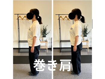 カワル整体 長嶺院/巻き肩