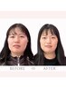 【たるみ改善・リフトアップ】小顔整体　初回体験　¥9,000 ⇒