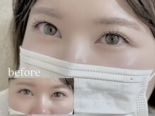 オリナ(Olina)/アンドヘルシー100本♪