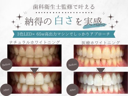 パオ(PAO)の写真
