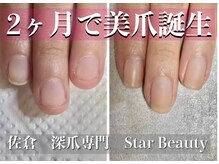 スターネイル(Starnail)/看護師さんバレずに育成