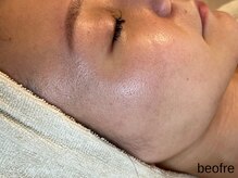 サロン ド エメ(salon de aimer)/【Before】くすみがちなお肌も♪