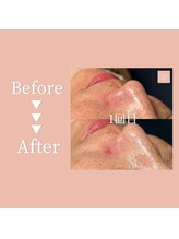 クリアラボ 豊中(Clear Lab)/Before&After