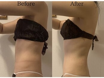 グランディール(GRANDIR)/【痩身】上半身コース4回