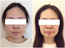 ウェリナ平和堂長久手院/小顔矯正/骨盤矯正/痩身/整体