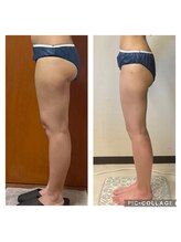 ビボディラボ 海老名店(美Body Labo)/セル撃退