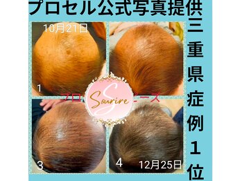 スリール(sourire)/三重県プロセル症例数No1圧倒的