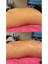 ブリア 横浜(BRILLA)/さようならぽっこりお腹