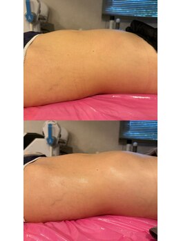 ブリア 横浜(BRILLA)/さようならぽっこりお腹