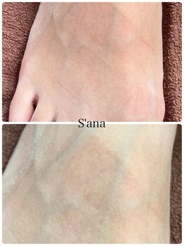 サナ 久が原 千鳥町(S’ana)/ルビッシュ照射