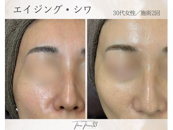 スリースリー(THREE THREE)/エイジング・しわケア