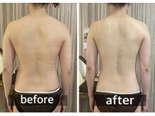 リムアール(Limh R)/ビフォーアフター