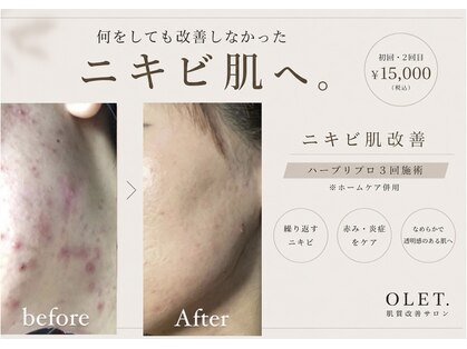 オレット(OLET.)の写真