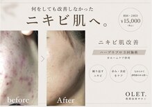 オレット(OLET.)